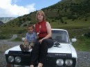Фотография Ожог Марины